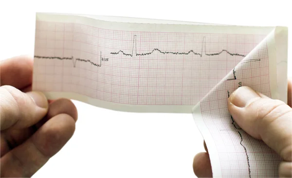 ECG of the patient in the doctor's hands — Stock Photo, Image