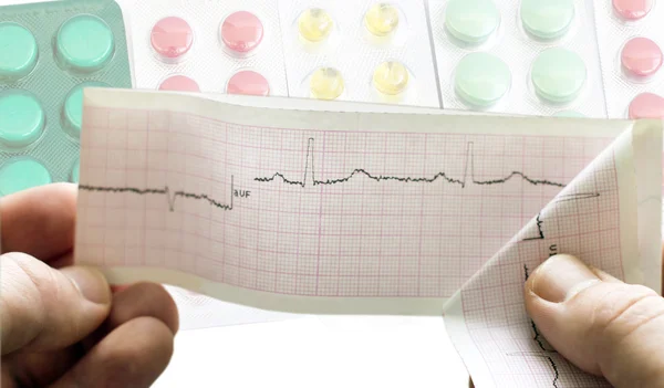 EKG i händerna på läkare mot bakgrund av olika — Stockfoto