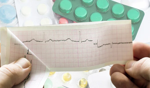 EKG i händerna på läkare mot bakgrund av olika — Stockfoto