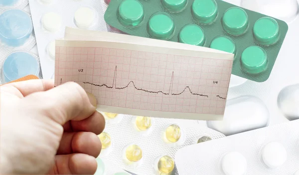 EKG i händerna på läkare mot bakgrund av olika — Stockfoto
