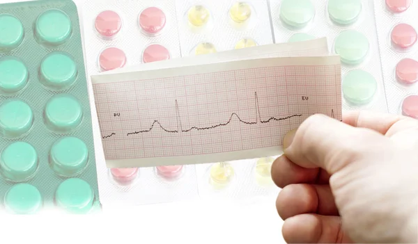 ECG nas mãos de médicos contra o pano de fundo de diferentes — Fotografia de Stock