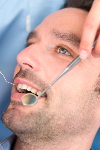 Detalhes de dentes brancos de um homem durante a cirurgia do dentista — Fotografia de Stock
