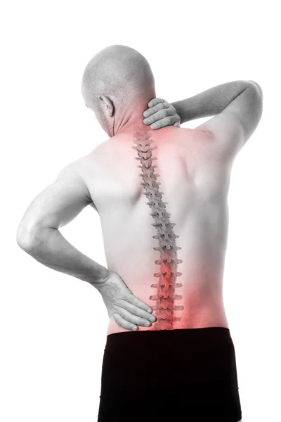 Напівголий чоловік відчуває біль у спині — стокове фото