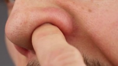 Adam temizler ya da burun deliğini karıştırır, kaşındıran burnunu kaşır, koku duyusunu kaybeder, yakından bakar.