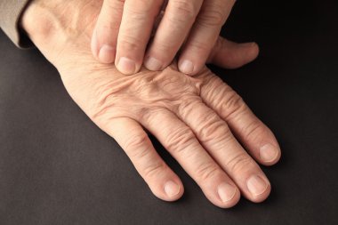 Ağrıyan el ile büyük adam 