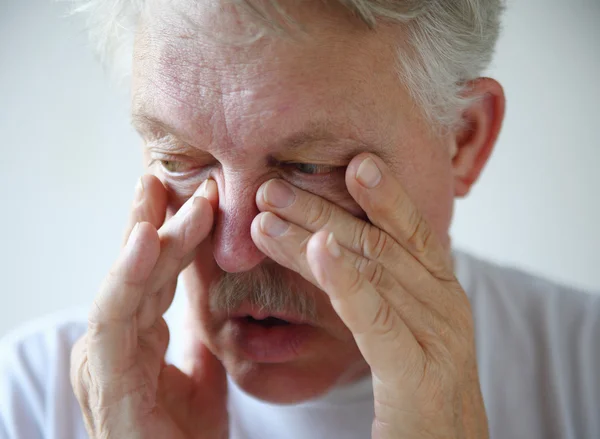 Man has nasal congestion — Stock Photo, Image