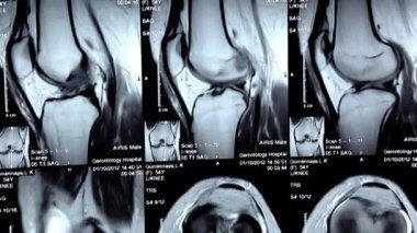 x-ışını resimler doktorlar office