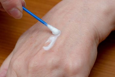 Bir el yumuşak cilt bakımı için pamuklu bez ile yatıştırıcı krem sürer..