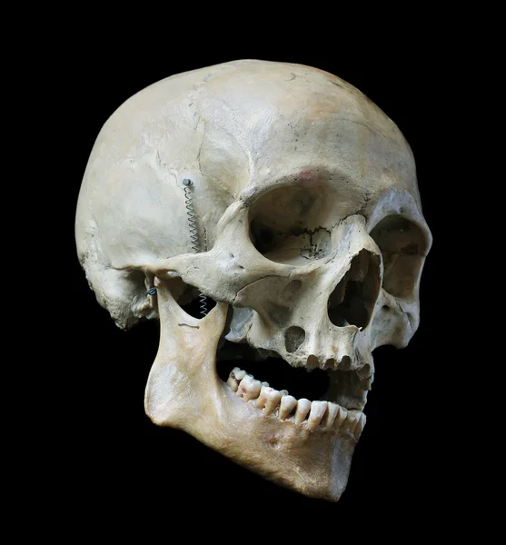 사람의 두개골. — 스톡 사진