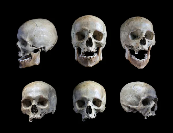 siyah zemin kişinin kafatası