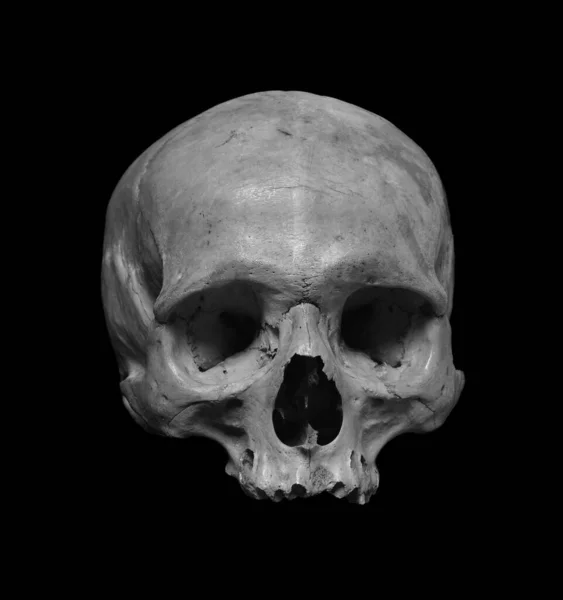 Skull Human Black White Photo — Stock Photo, Image