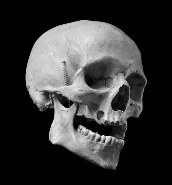 Cráneo Del Humano Aislado Sobre Fondo Negro Foto Blanco Negro — Foto de Stock