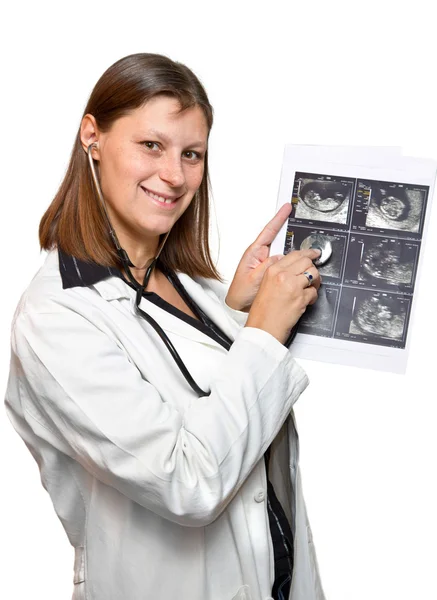 Doctors looking at echography — Stock Photo, Image