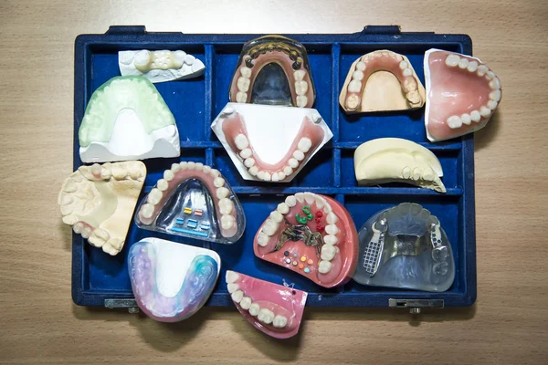 Suitcase full of prosthetic equipment — Stock Photo, Image