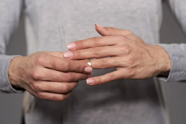 女性は結婚指輪を外して手を閉じて — ストック写真