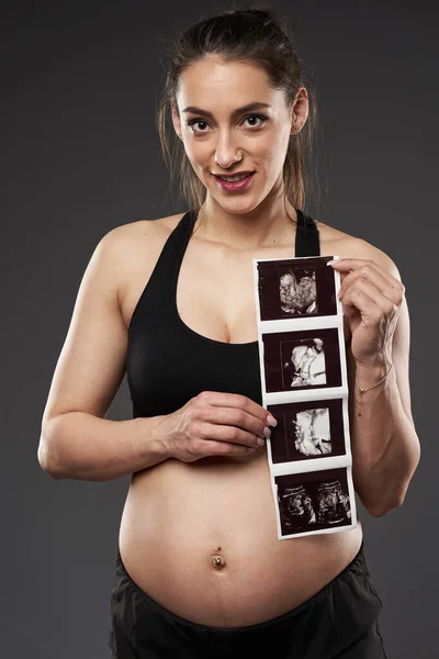 Joven Embarazada Fitness Mujer Orgullosamente Mostrando Bebé Fetal Morfología Exploración — Foto de Stock