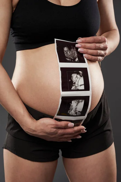 Mladá Těhotná Fitness Žena Hrdě Ukazuje Své Dítě Fetální Morfologie — Stock fotografie