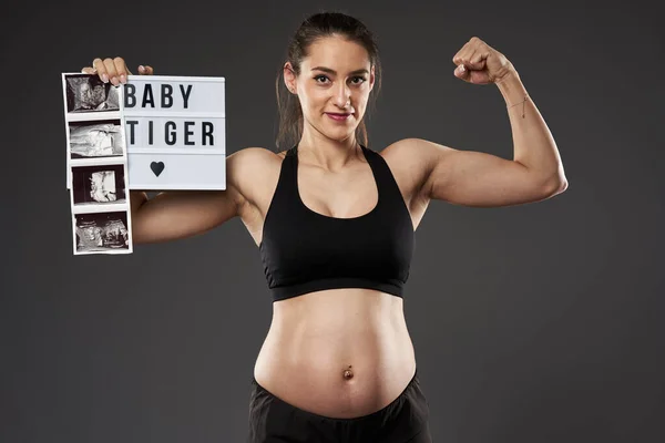 Genç Hamile Kadın Gururla Bebeğinin Morfoloji Taramasını Gösteriyor — Stok fotoğraf