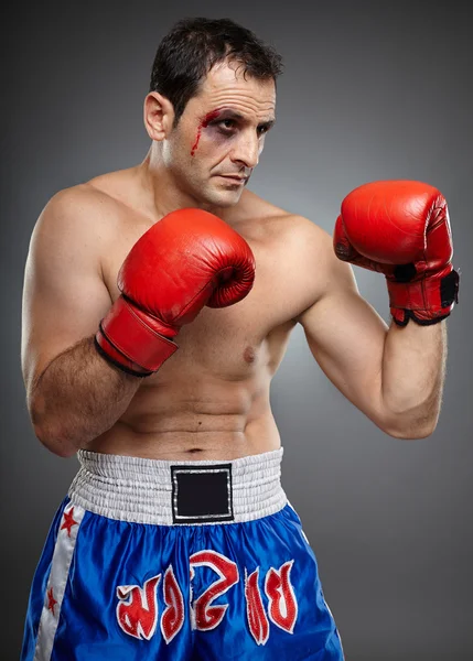 Bruised fighter ready to punch — Stock Photo, Image