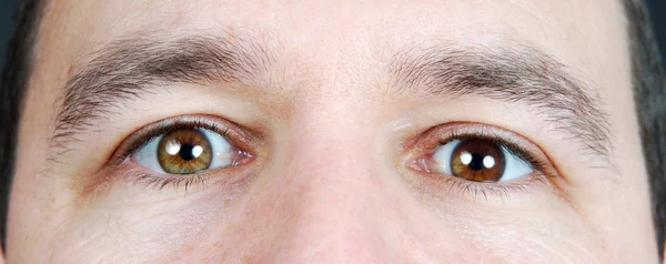 Heterochromia iridum — стокове фото