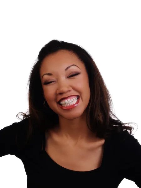 Big Smile Showing Braces Upper Teeth Black Woman — Stock Photo, Image