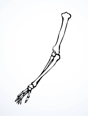 Arkaya bakan hasta kadın, omurga yaralanması bilek ağrısı, ameliyat, terap tarama, röntgen, beyaz logo. Siyah çizilmiş kadın yaralanması başparmak sıhhiyesi, Xray dirsek ağrısı, dirsek ağrısı, çizim sanatı.