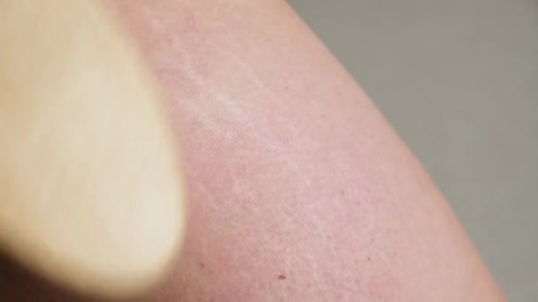 Close Cellulite Trockenbürstenmassage Von Echter Frauenhaut Mit Dehnungsstreifen Gesäß — Stockvideo