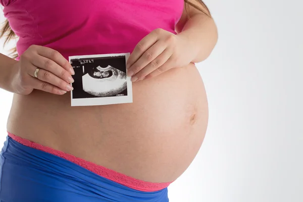 Mulher grávida segurando ultra-som foto da varredura de seu bebê isolado — Fotografia de Stock