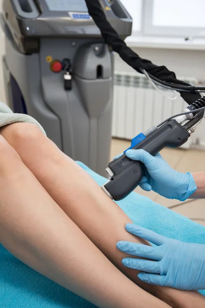 Epilazione delle gambe laser — Foto Stock