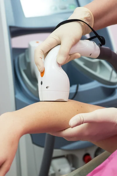 Photo epilation — Stock Photo, Image