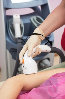 Lazer veya Foto epilasyon