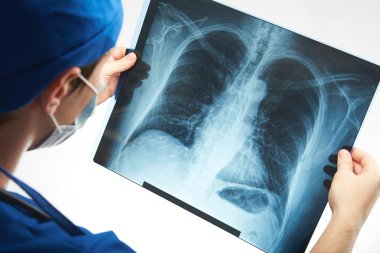 İnsan Göğsünün X-Ray Görüntüsü