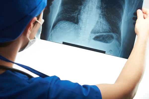 Médico mira la imagen de rayos X — Foto de Stock