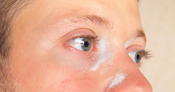 Irritação da pele e dos olhos do jovem — Fotografia de Stock