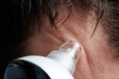 Siyah başlıkların alnı temizleniyor makro yakın görünüm