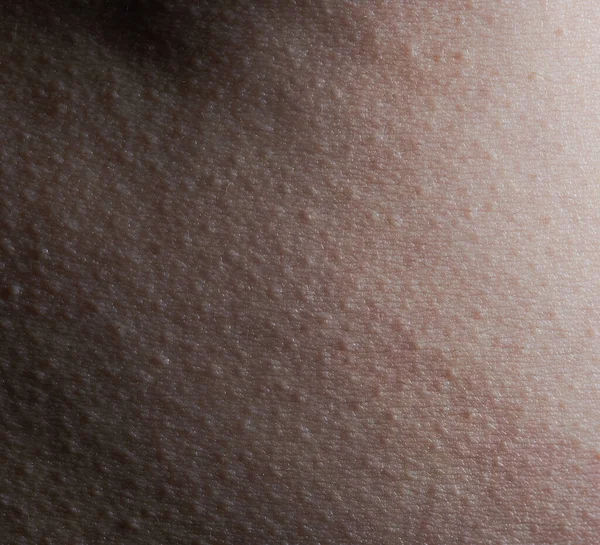人間の皮膚ケアのテーマ バンプできれいな肌の質感 — ストック写真