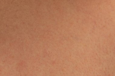 Boş insan derisi dokusu arka plan makrosu yakın görünüm