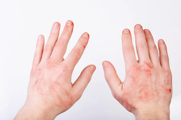 Mãos cobertas de sangue — Fotografia de Stock