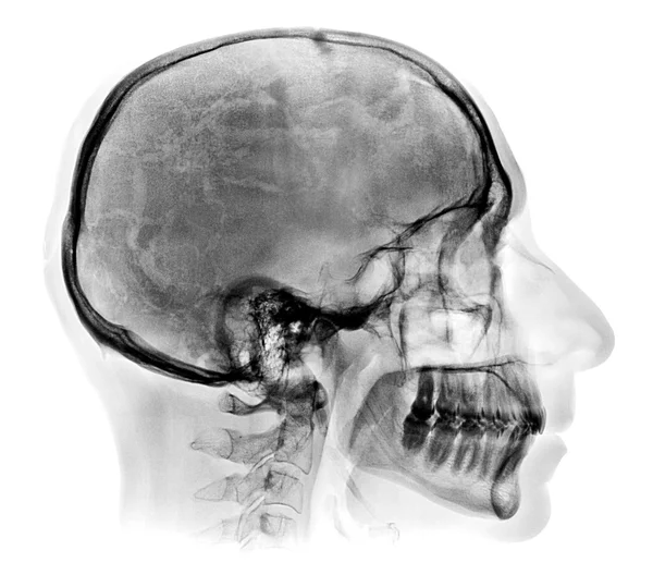 Podrobné lidská lebka rentgenový obraz — Stock fotografie