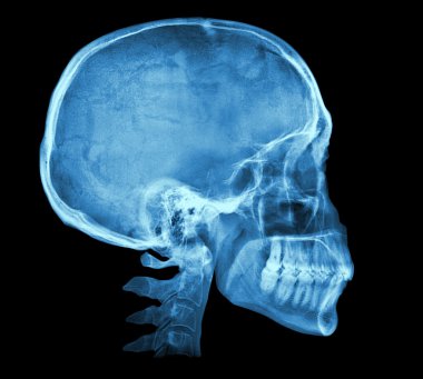 İnsan kafatası X-ray görüntü