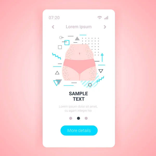 Celluliter problemområden av kvinnlig kroppsviktminskning fett kost koncept smartphone skärm mobil app kopiera utrymme — Stock vektor
