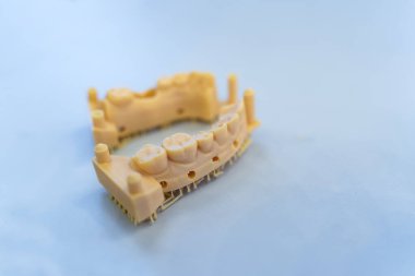 Bir fotopolimer materyalden 3D yazıcı.