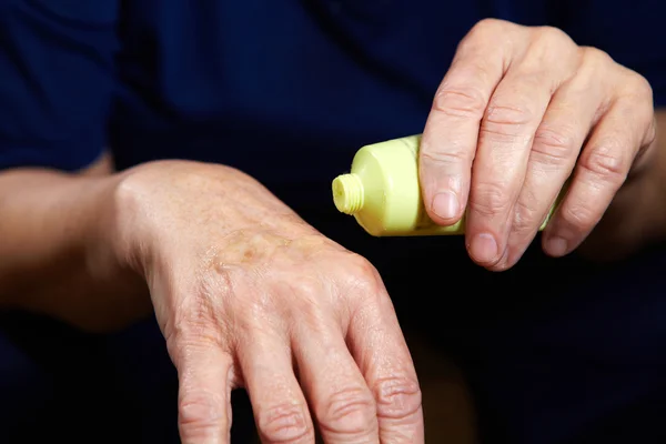 Anti aging cream for hands — Stock Photo, Image