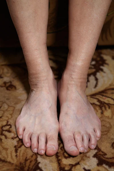 Legs of senior woman — Stock Photo, Image