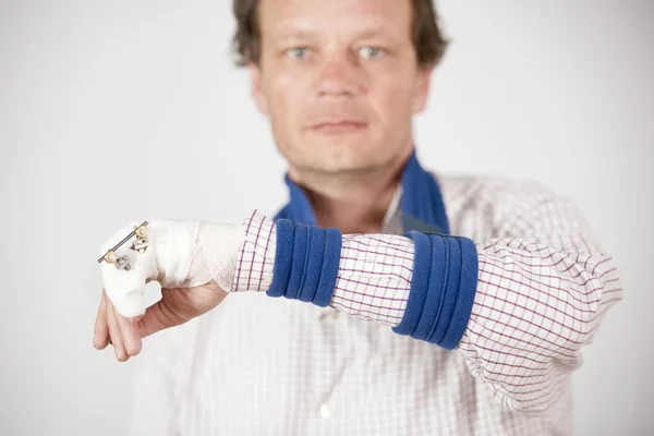 Man showing fracture — Stock Photo, Image