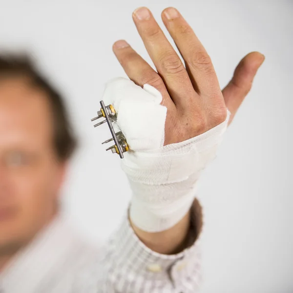 Hand with complex fracture — Stock Photo, Image