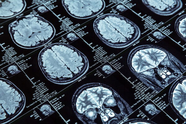 Magnetic resonance imaging