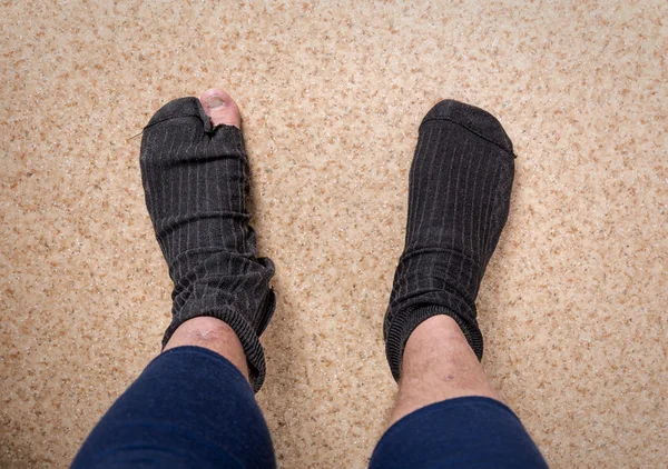 Male feet with sock in hole — Stock Photo, Image