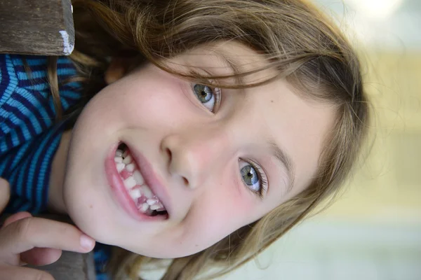 Niño con dientes faltantes sonriendo — Foto de Stock