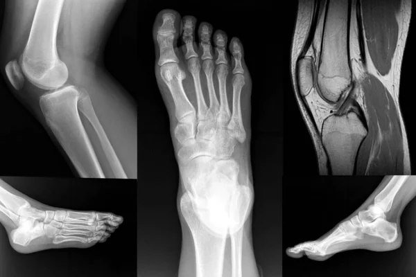 Orthopädische Collage Von Fuß Und Knie Röntgen — Stockfoto